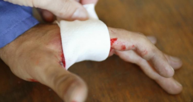 Fingertip Injuries and Amputation